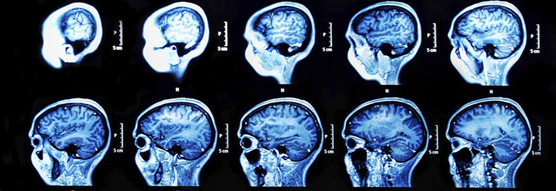 Why Do We Focus on the Prenatal-to-3 Age Period?